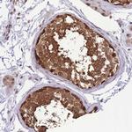 CDIP1 Antibody in Immunohistochemistry (Paraffin) (IHC (P))