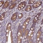WDR90 Antibody in Immunohistochemistry (IHC)