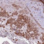 WDR90 Antibody in Immunohistochemistry (IHC)