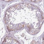 WDR90 Antibody in Immunohistochemistry (IHC)