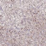 C18orf42 Polyclonal Antibody