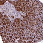 C16orf74 Antibody in Immunohistochemistry (Paraffin) (IHC (P))