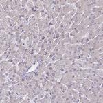 BCL9L Antibody in Immunohistochemistry (Paraffin) (IHC (P))