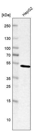 SNX6 Antibody in Western Blot (WB)