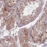 TMEM232 Polyclonal Antibody