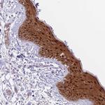 FBXO46 Antibody in Immunohistochemistry (Paraffin) (IHC (P))