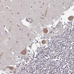 HYAL3 Antibody in Immunohistochemistry (Paraffin) (IHC (P))