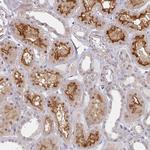 HYAL3 Antibody in Immunohistochemistry (Paraffin) (IHC (P))