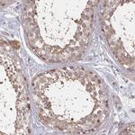 HYAL3 Antibody in Immunohistochemistry (Paraffin) (IHC (P))
