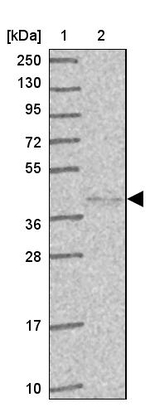 HYAL3 Antibody in Western Blot (WB)