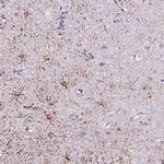 SLC35E3 Antibody in Immunohistochemistry (IHC)