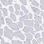 FKBP2 Antibody in Immunohistochemistry (IHC)