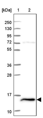 FKBP2 Antibody in Western Blot (WB)