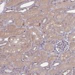 Naked1 Antibody in Immunohistochemistry (Paraffin) (IHC (P))