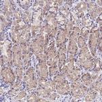 SPIRE2 Polyclonal Antibody