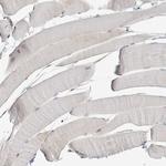 LILRA4 Antibody in Immunohistochemistry (Paraffin) (IHC (P))