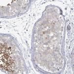 LILRA4 Polyclonal Antibody