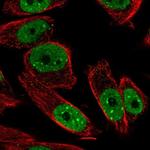 ANKRD29 Polyclonal Antibody