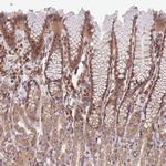 CHD9 Polyclonal Antibody