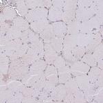 DOCK6 Antibody in Immunohistochemistry (Paraffin) (IHC (P))