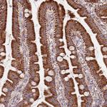 DOCK6 Antibody in Immunohistochemistry (Paraffin) (IHC (P))