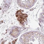 DOCK6 Antibody in Immunohistochemistry (Paraffin) (IHC (P))