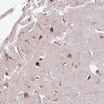 DOCK6 Antibody in Immunohistochemistry (Paraffin) (IHC (P))
