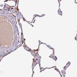 DOCK6 Antibody in Immunohistochemistry (Paraffin) (IHC (P))