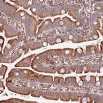 DOCK6 Polyclonal Antibody