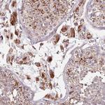 DOCK6 Antibody in Immunohistochemistry (Paraffin) (IHC (P))