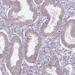 SMPD4 Antibody in Immunohistochemistry (Paraffin) (IHC (P))