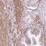 SMPD4 Antibody in Immunohistochemistry (Paraffin) (IHC (P))