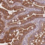 SMPD4 Antibody in Immunohistochemistry (Paraffin) (IHC (P))