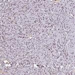 NOB1 Polyclonal Antibody