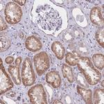 QTRT1 Polyclonal Antibody