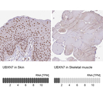 UBXN7 Antibody in Immunohistochemistry (Paraffin) (IHC (P))