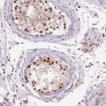 UBXN7 Antibody in Immunohistochemistry (Paraffin) (IHC (P))