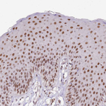UBXN7 Antibody in Immunohistochemistry (Paraffin) (IHC (P))