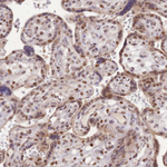UBXN7 Antibody in Immunohistochemistry (Paraffin) (IHC (P))