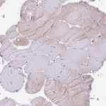 UBXN7 Antibody in Immunohistochemistry (Paraffin) (IHC (P))