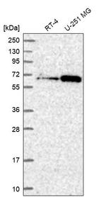 UBXN7 Antibody in Western Blot (WB)
