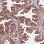 CFAP97 Antibody in Immunohistochemistry (Paraffin) (IHC (P))