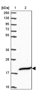 CFAP97 Antibody in Western Blot (WB)