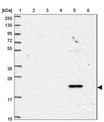NBEAL1 Antibody in Western Blot (WB)