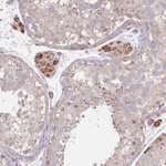 SLC25A42 Antibody in Immunohistochemistry (Paraffin) (IHC (P))