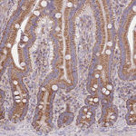 SLC25A42 Antibody in Immunohistochemistry (Paraffin) (IHC (P))