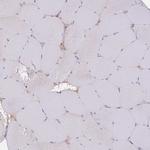 RAVER1 Antibody in Immunohistochemistry (Paraffin) (IHC (P))