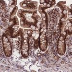 RAVER1 Antibody in Immunohistochemistry (Paraffin) (IHC (P))