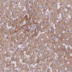 Adenylate Kinase 4 Antibody in Immunohistochemistry (Paraffin) (IHC (P))
