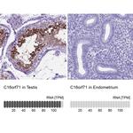 C16orf71 Antibody in Immunohistochemistry (IHC)
